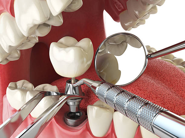 Best 24-Hour Emergency Dentist in Wellington, TX